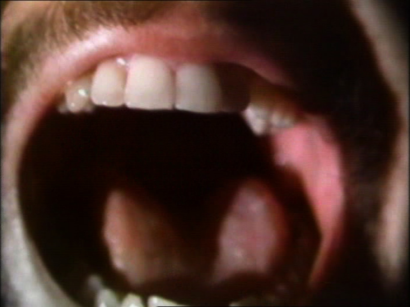 Werk - The Space Between the Teeth - s09102.jpg